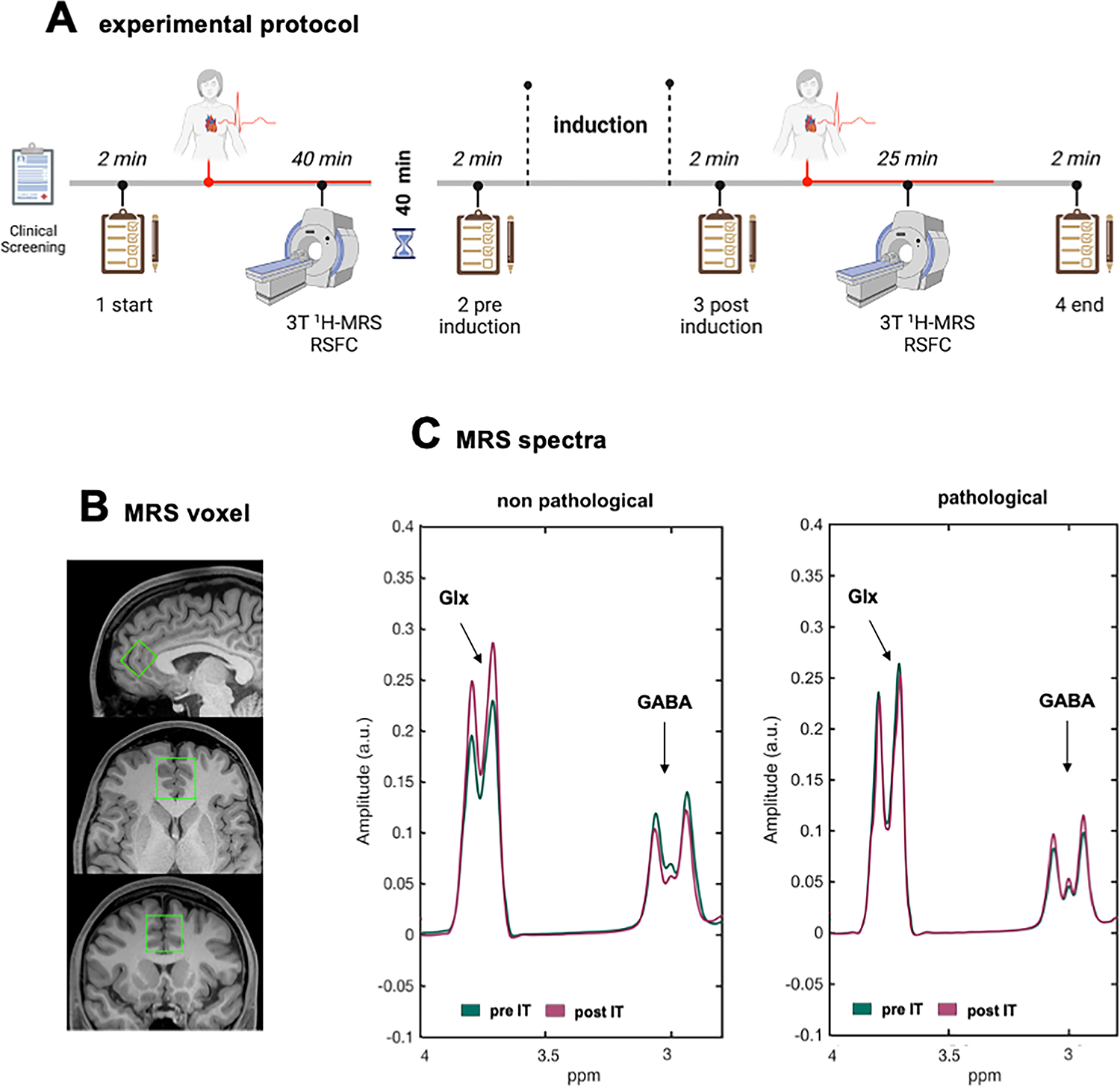 State-dependent reactivity of anterior cingulate cortex neurochemistry and downstream autonomic arousal in intrusive thinking