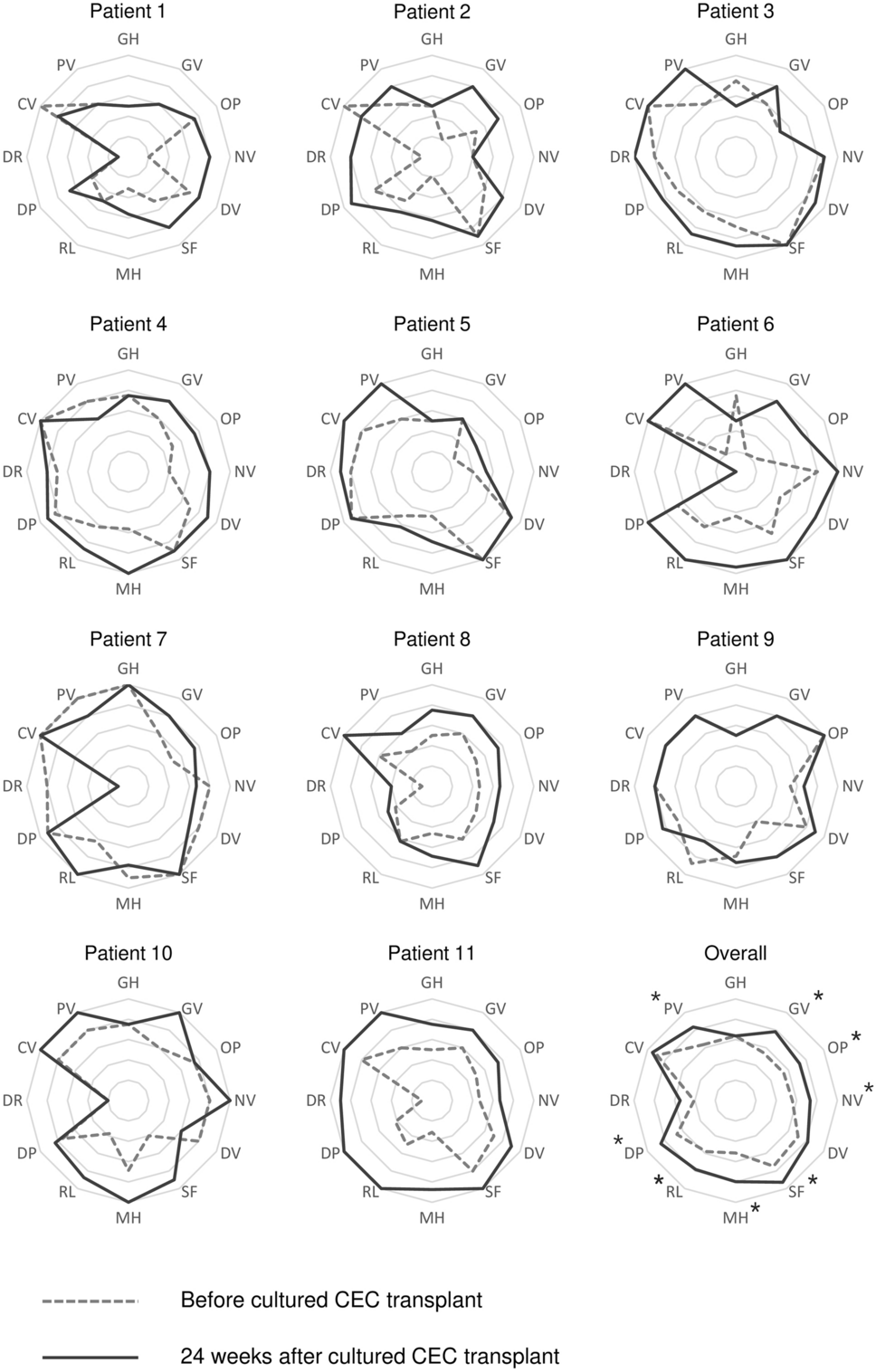 Quality of life after cultured corneal endothelial cell transplant in patients with bullous keratopathy