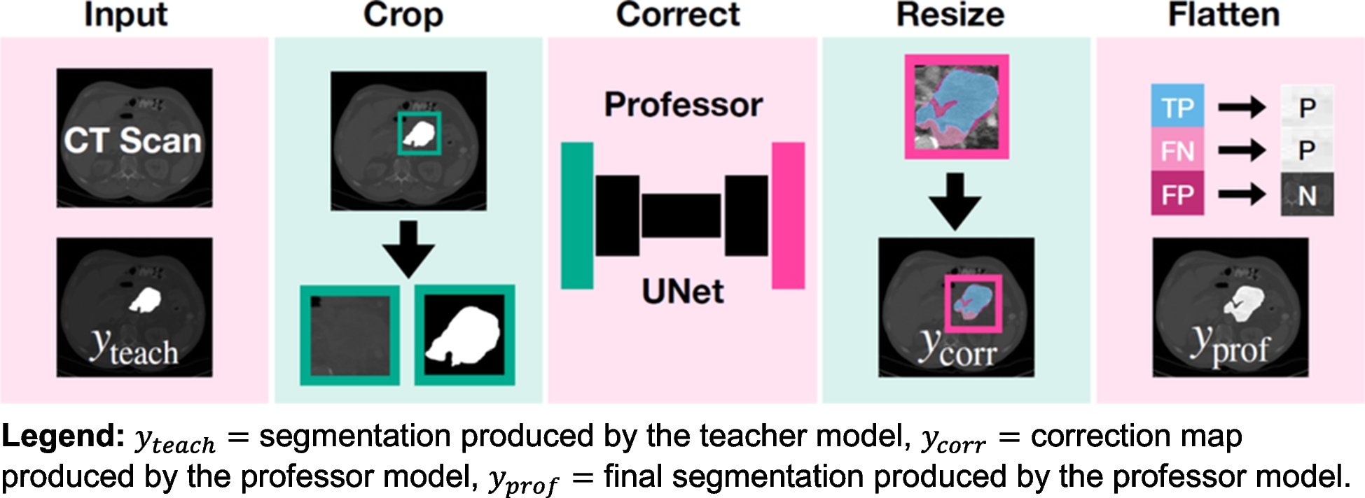 Refining the Classroom: The Self-Supervised Professor Model for Improved Segmentation of Locally Advanced Pancreatic Ductal Adenocarcinoma