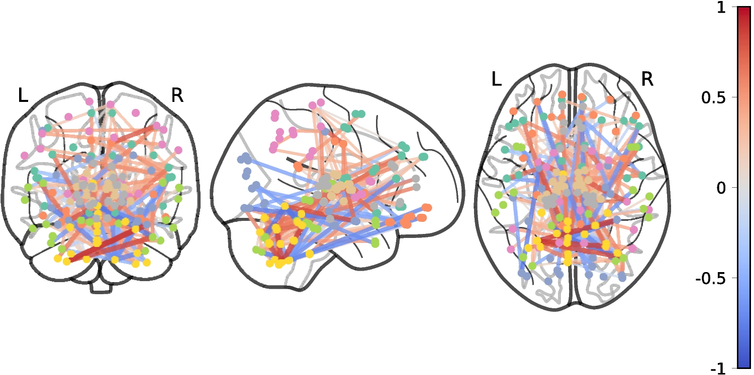 Sketching a Space of Brain States