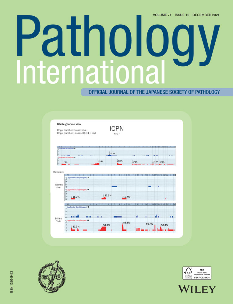 Asbestos‐induced mesothelial injury and carcinogenesis: Involvement of iron and reactive oxygen species